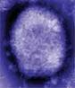 Monkeypox Virus