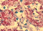 guinea pig granuloma photo